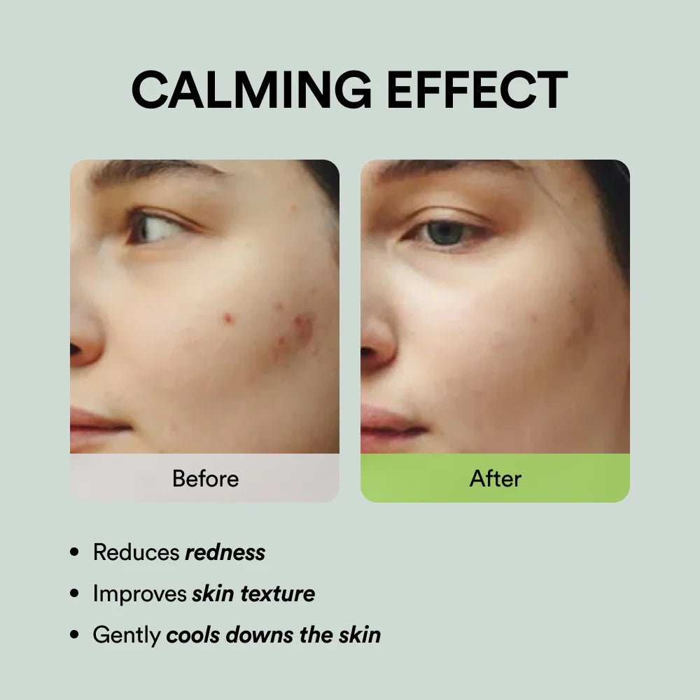 Abib Heartleaf Spot Pad Calming Touch 150ml (80 pads) - Beauty Tribe