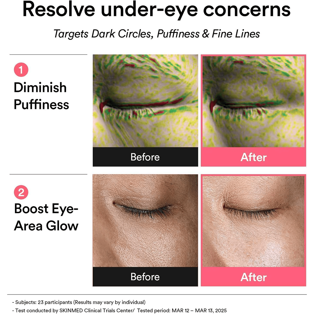Abib PDRN Retinal Eye Patch Glow Jelly - Beauty Tribe