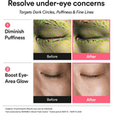 Abib PDRN Retinal Eye Patch Glow Jelly - Beauty Tribe