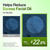 Anua Azelaic Acid 10 Hyaluron Redness Soothing Serum 30ml - Beauty Tribe