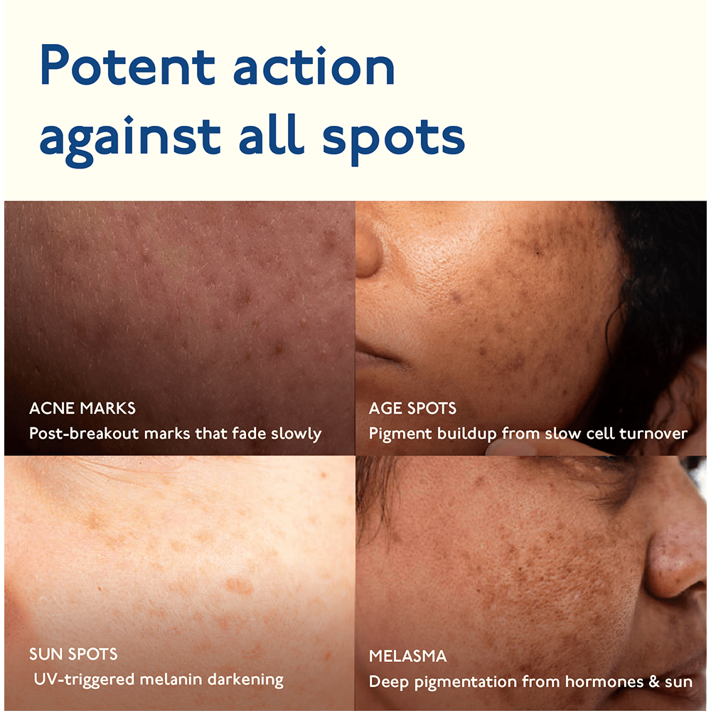 Asaya Advanced Spot Gel 15g - Beauty Tribe