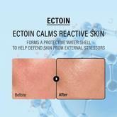 Epii Double Up Cream Ectoin & Panthenol - Beauty Tribe