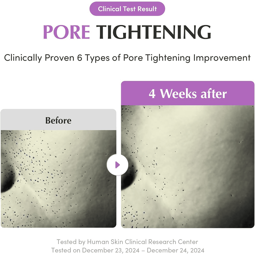 Eqqualberry Purple PDRN Pore Minimizing Serum 30ml - Beauty Tribe