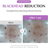 Eqqualberry Purple PDRN Pore Purifying Pack Cleanser 130g - Beauty Tribe