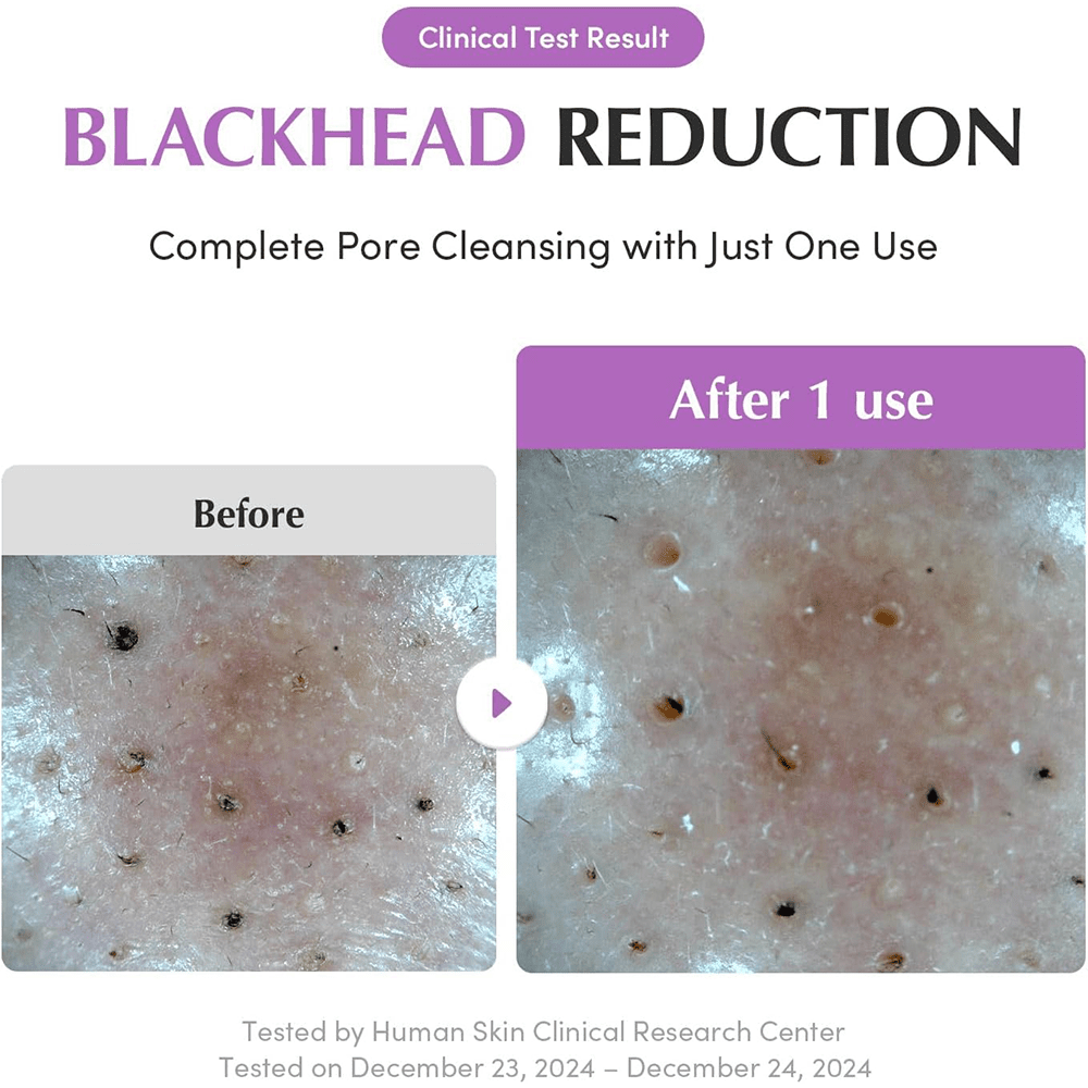 Eqqualberry Purple PDRN Pore Purifying Pack Cleanser 130g - Beauty Tribe