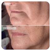 Image Skincare VOL.U.LIFT™ GLP-1 4D Skin Rebound Complex 57g - Beauty Tribe