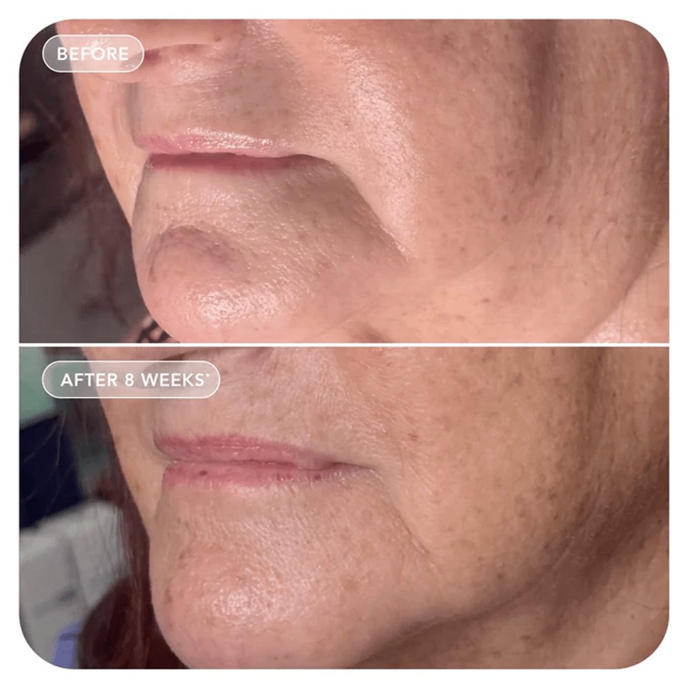 Image Skincare VOL.U.LIFT™ GLP-1 4D Skin Rebound Complex 57g - Beauty Tribe