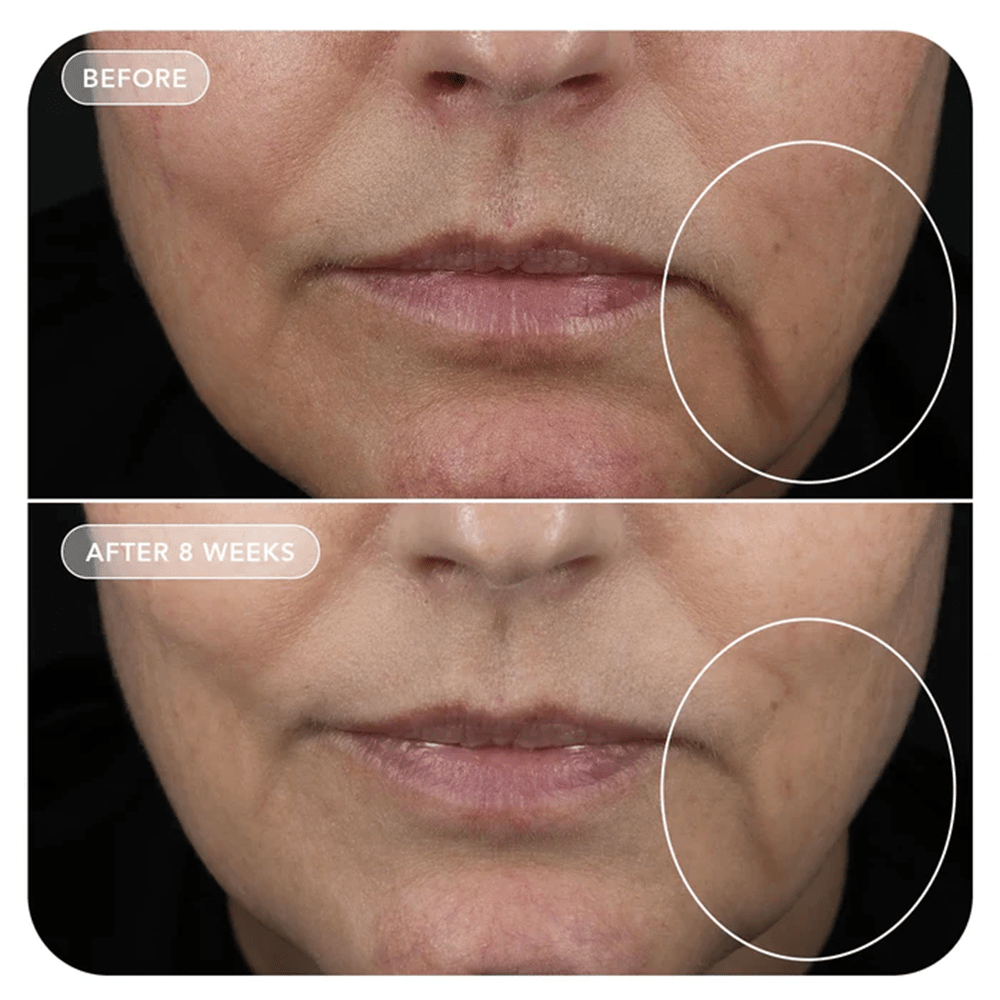 Image Skincare VOL.U.LIFT™ GLP-1 4D Skin Rebound Complex 57g - Beauty Tribe