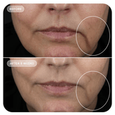 Image Skincare VOL.U.LIFT™ GLP-1 4D Skin Rebound Complex 57g - Beauty Tribe