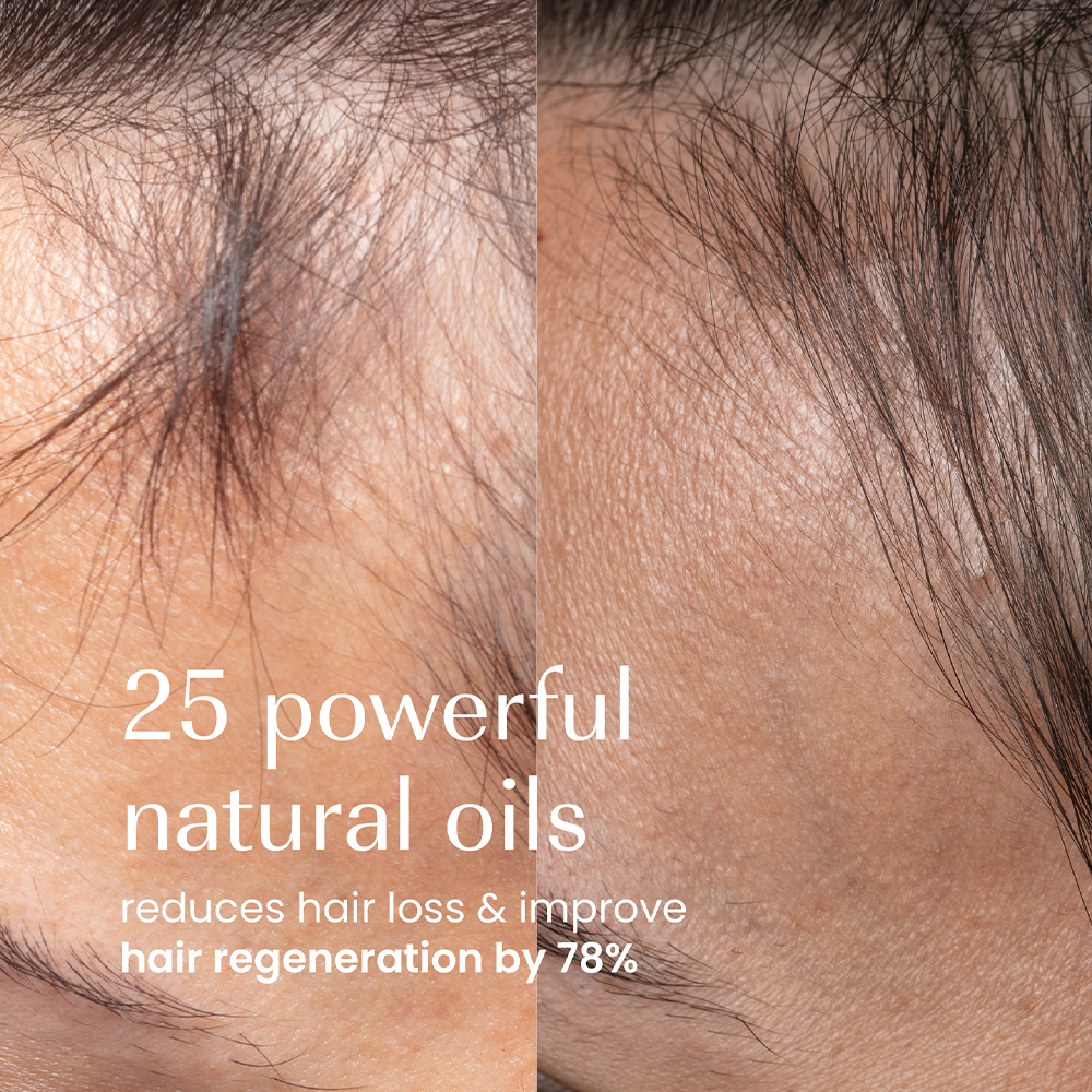 Izil Beauty Densify Strengthening Hair Oil 190ml