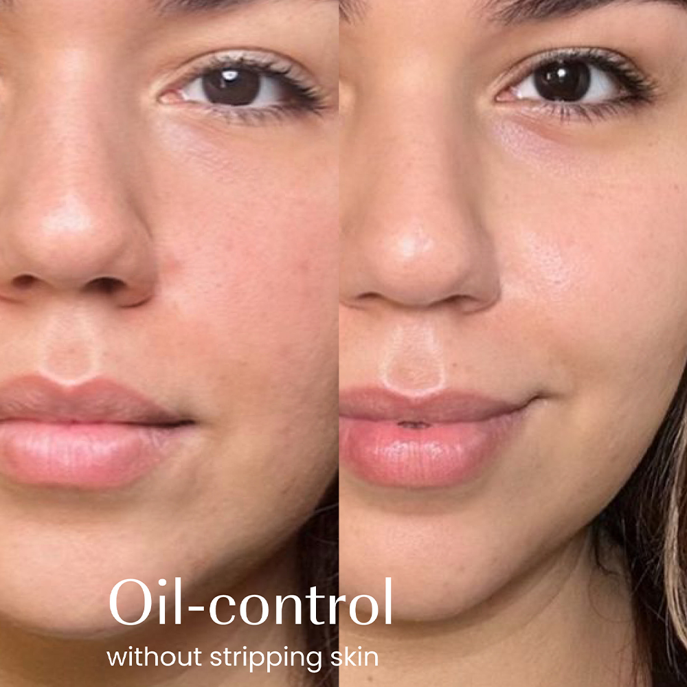 Izil Beauty Green Tea Oil Control Gel Cleanser 150ml