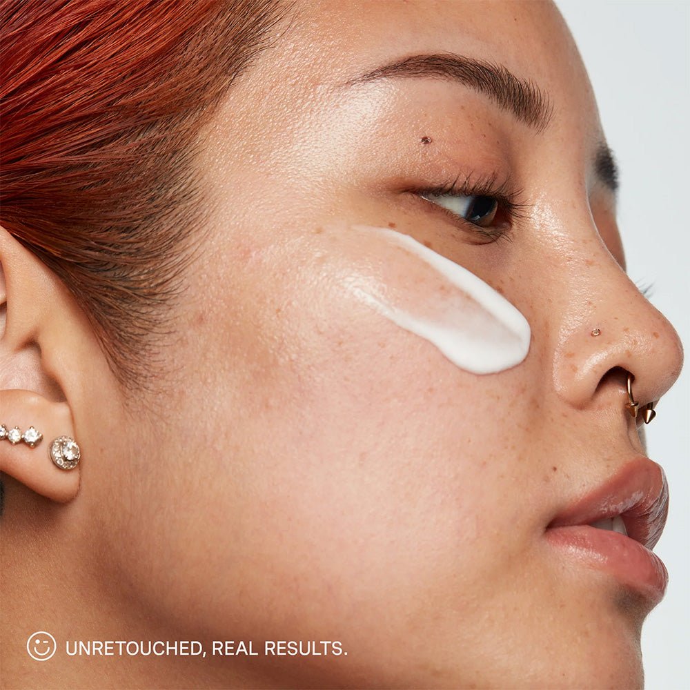 Kate Somerville Breakout Busters EradiKate Set - Beauty Tribe