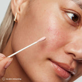 Kate Somerville EradiKate Acne Treatment 1oz - Beauty Tribe