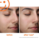 Kate Somerville ExfoliKate Cleanser Daily Foaming Wash 4oz/120mL - Beauty Tribe