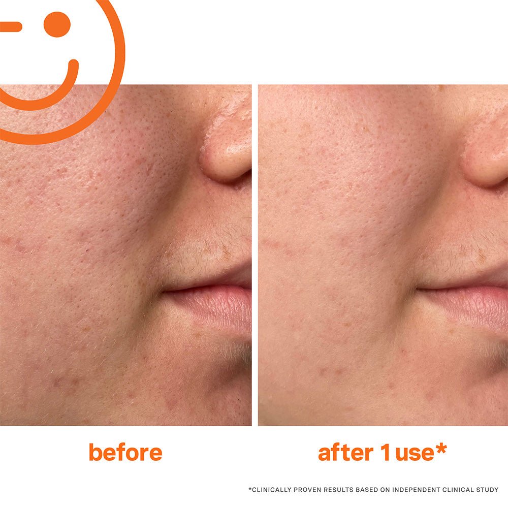 Kate Somerville ExfoliKate Intensive Exfoliating Treatment - 60 ml / 2 fl oz - Beauty Tribe