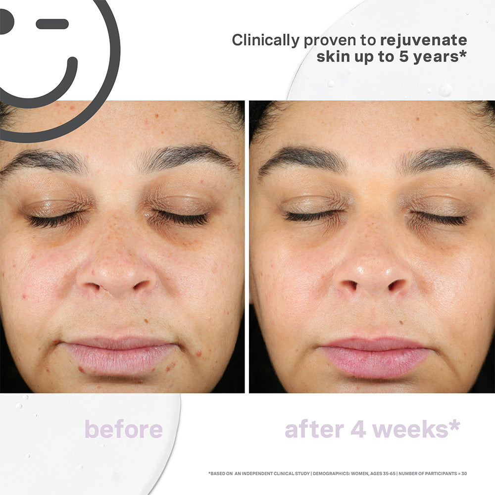Kate Somerville Kateceuticals Supercell Rejuvenation Serum - 1oz/30