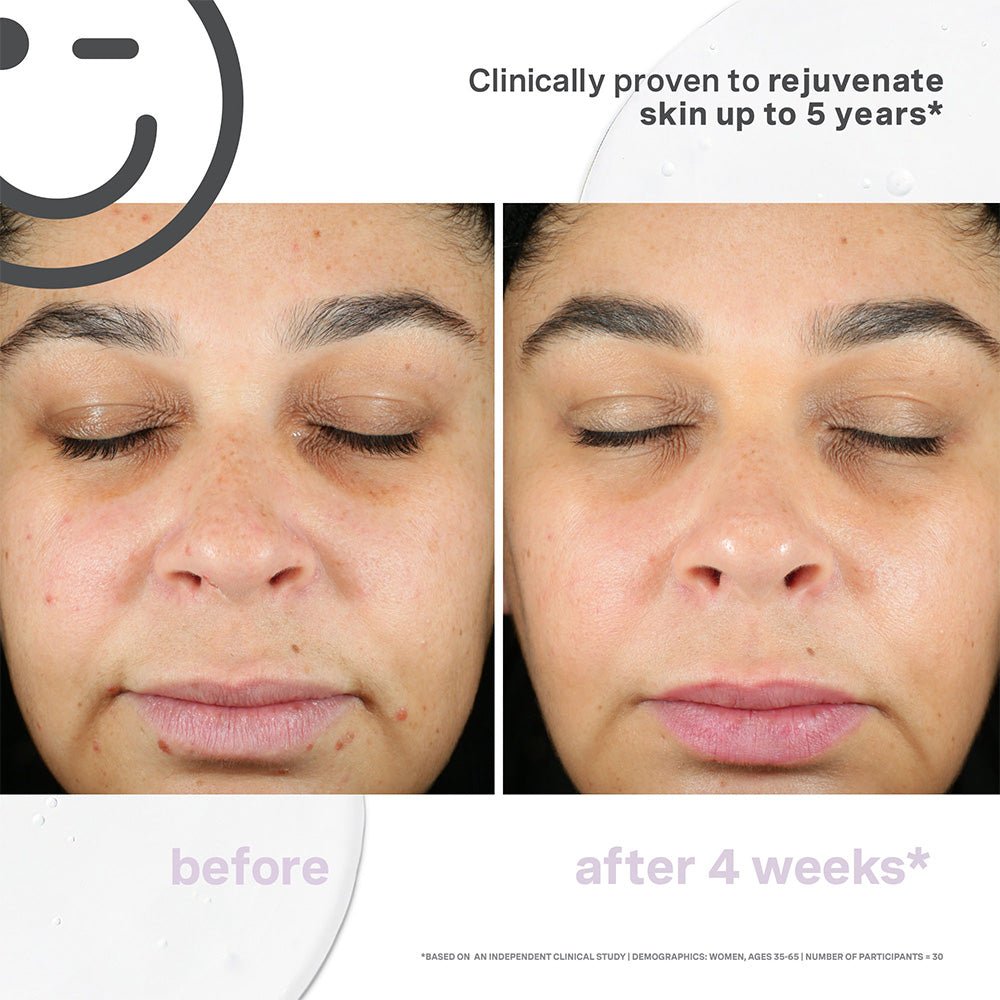 Kate Somerville Kateceuticals Supercell Rejuvenation Serum - 1oz/30 - Beauty Tribe