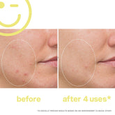 Kate Somerville Mega C 30% Vitamin C Brightening Facial 60ml/ 2oz - Beauty Tribe