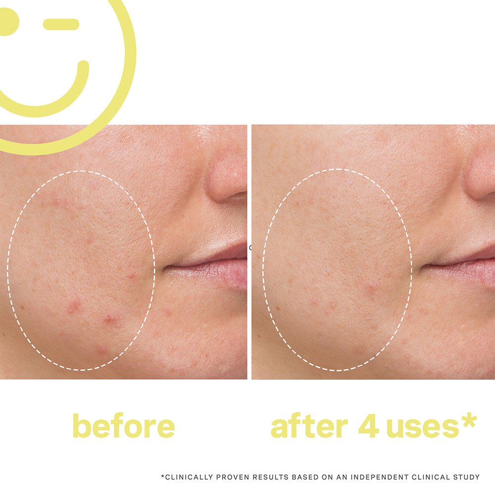 Kate Somerville Mega C 30% Vitamin C Brightening Facial 60ml/ 2oz - Beauty Tribe