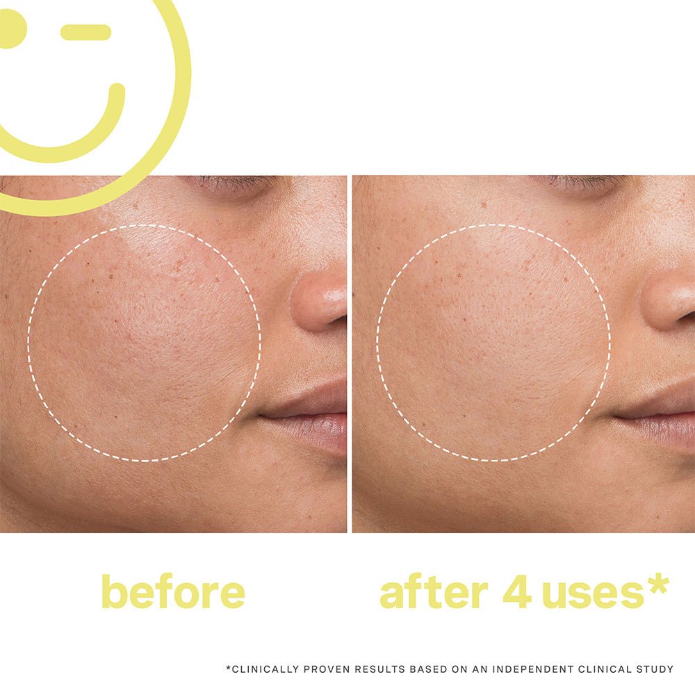 Kate Somerville Mega C 30% Vitamin C Brightening Facial 60ml/ 2oz - Beauty Tribe