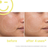 Kate Somerville Mega C 30% Vitamin C Brightening Facial 60ml/ 2oz - Beauty Tribe