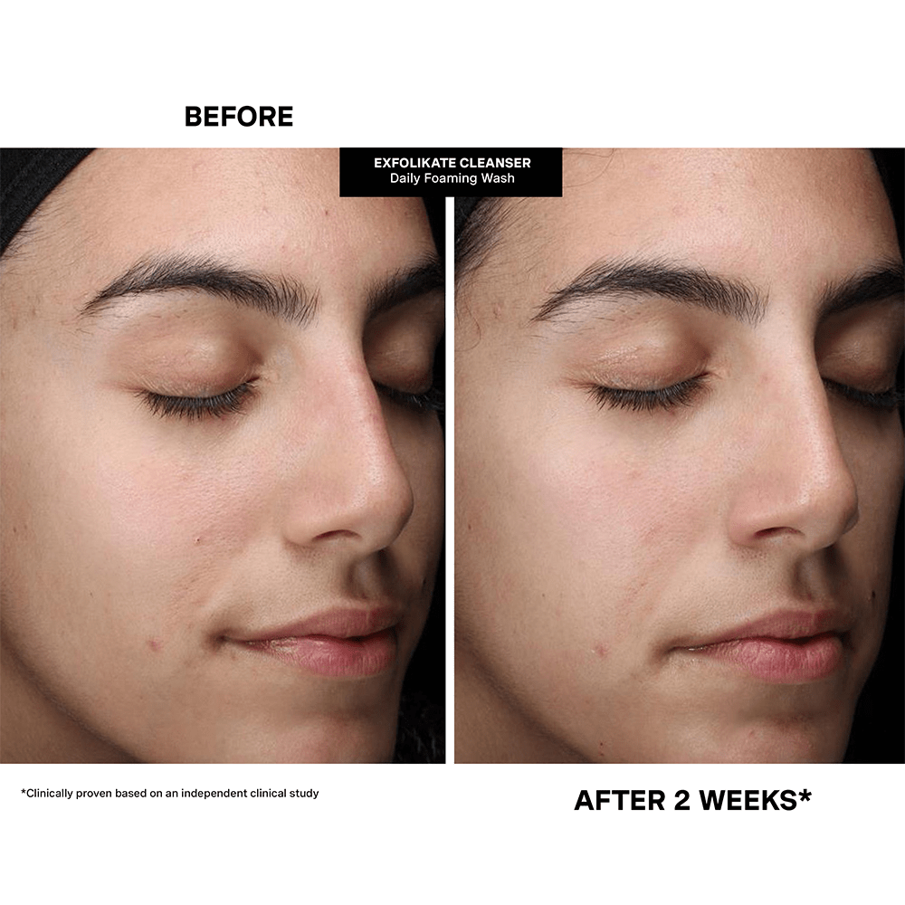 Kate Somerville Pore - fect Holiday Trio – 2025 Holiday Kit - Beauty Tribe