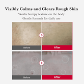 Medicube Red Body Peeling Shot AHA + BHA Exfoliating Body Spray 120ml - Beauty Tribe