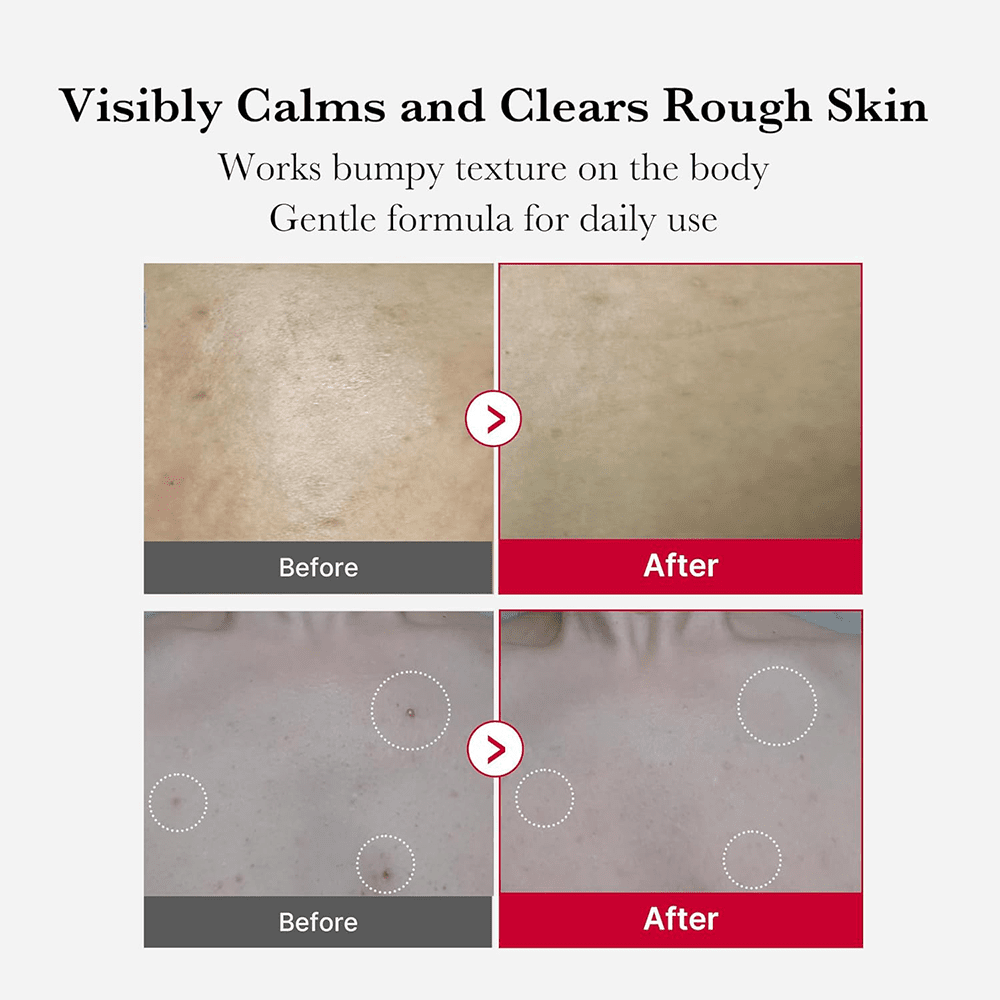 Medicube Red Body Peeling Shot AHA + BHA Exfoliating Body Spray 120ml - Beauty Tribe