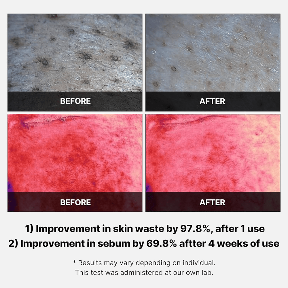 Medicube Red Succinic Peeling Pad 155g - Beauty Tribe