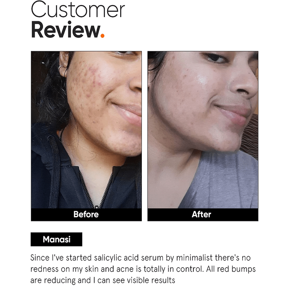 Minimalist 2% Salicylic Acid Serum For Oily Skin 30ml - Beauty Tribe