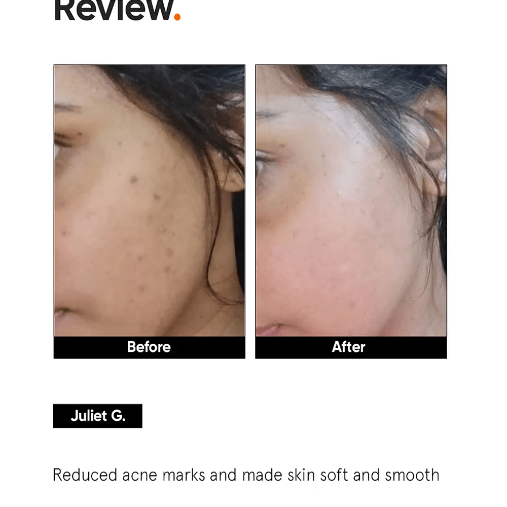 Minimalist Niacinamide 5% Face Serum with Vit B3 30ml - Beauty Tribe