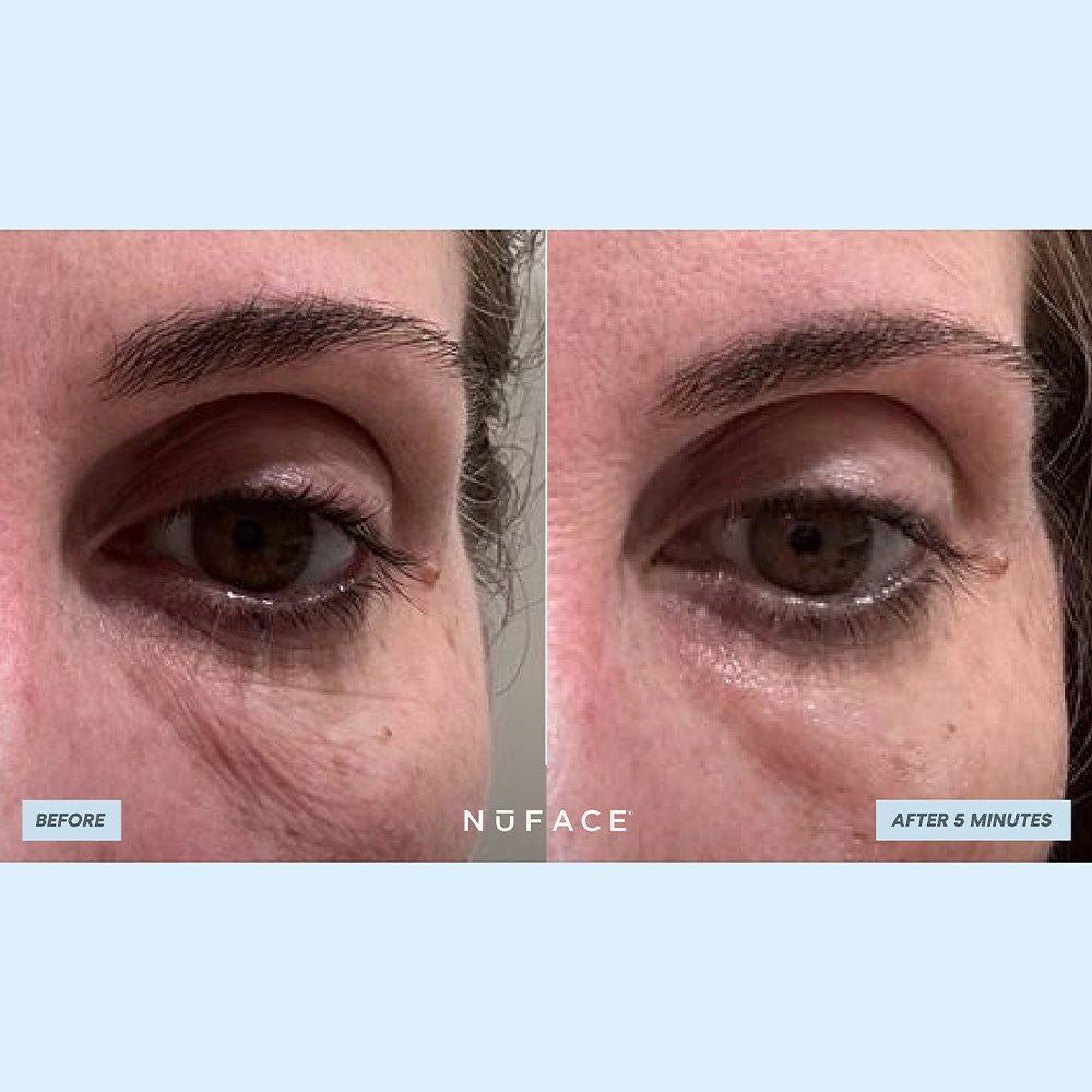 Nuface IonPlex Hydra - Gel Power Eye Patches 30pc - Beauty Tribe