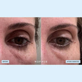 Nuface IonPlex Hydra - Gel Power Eye Patches 30pc - Beauty Tribe