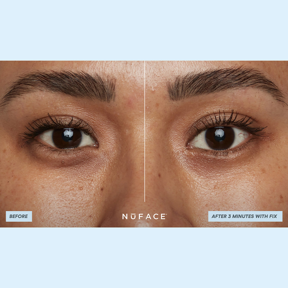 Nuface IonPlex Hydra-Gel Power Eye Patches 30pc
