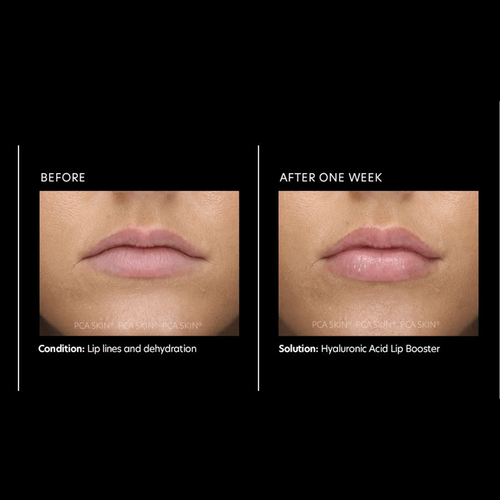 PCA Hyaluronic Acid Lip Booster 6g - Beauty Tribe
