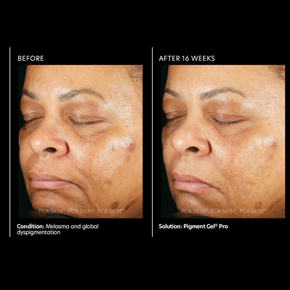 PCA Pigment Gel® Pro 29ml - Beauty Tribe