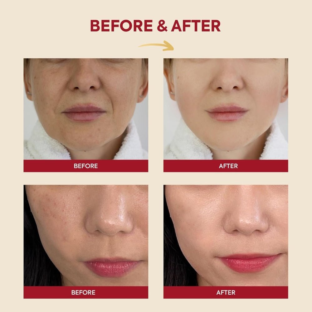 SEOUL 1988 Essence - Snail Mucin 97% + Rice 100ml - Beauty Tribe