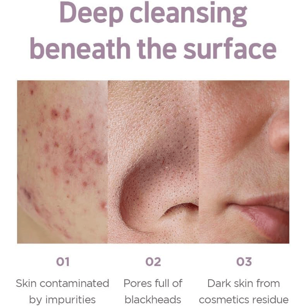 Zombie Beauty By Skin1004 Cocoon Soap Mask - Beauty Tribe