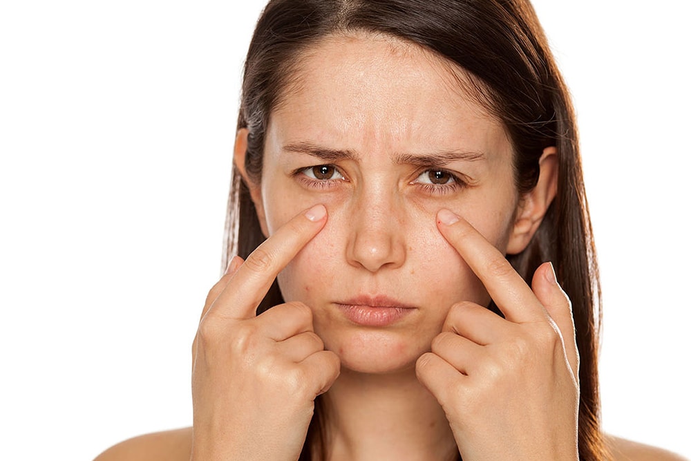 5 Products That That Work For Dark Circles