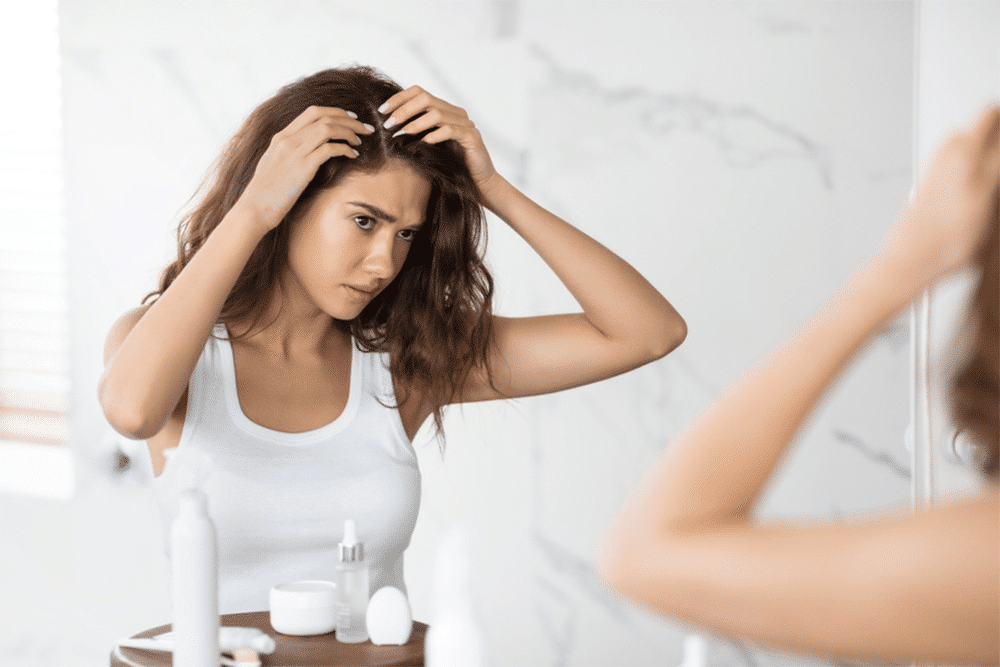 How to Control Dandruff - Beauty Tribe