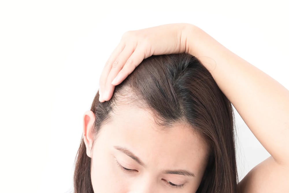 What Are The Causes, Symptoms, And Treatments For Hair loss - Beauty Tribe