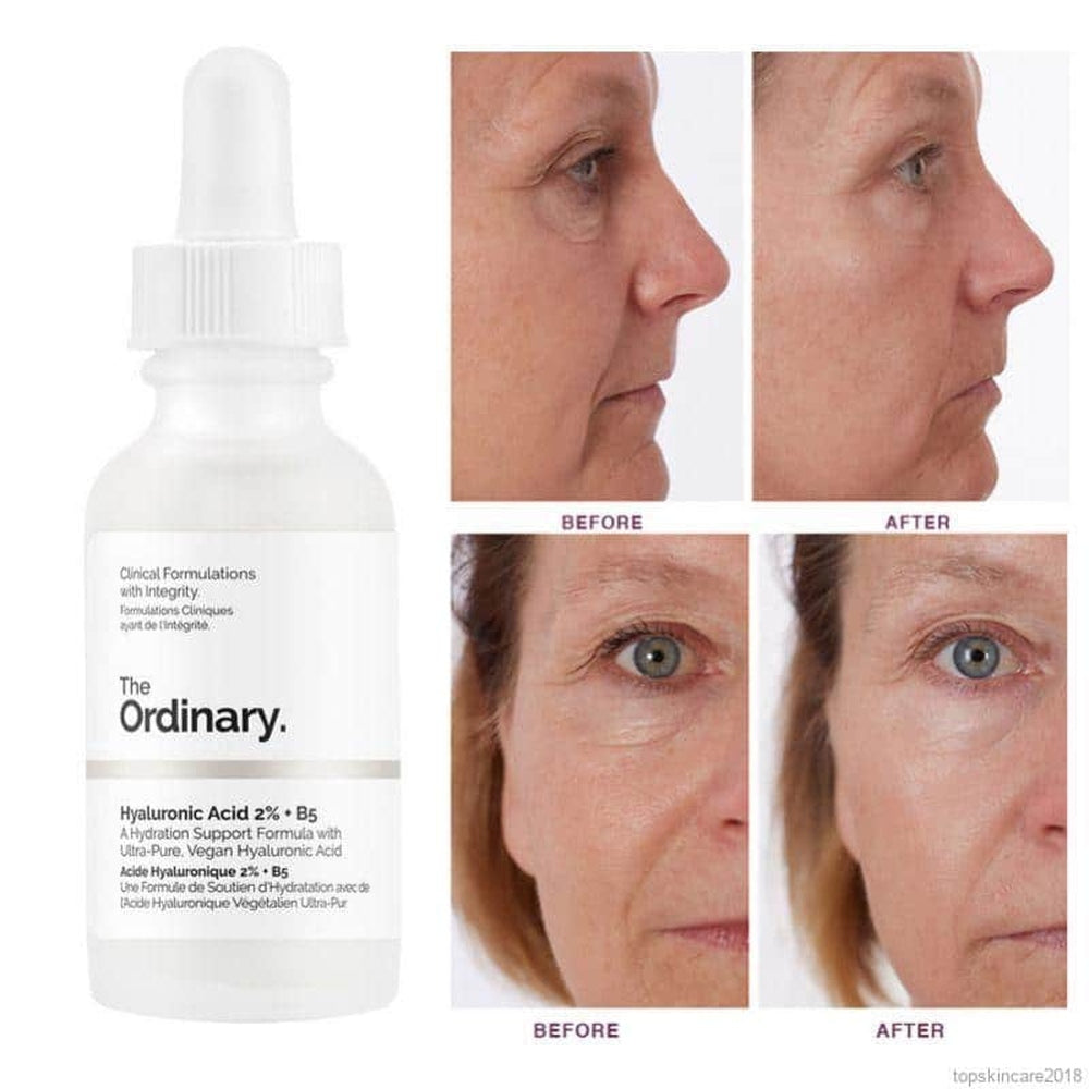 The Ordinary Hyaluronic Acid 2% B5 2%30ml