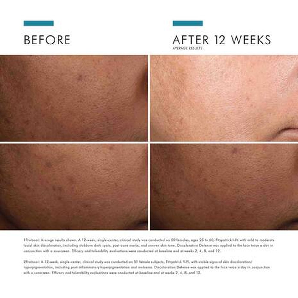 Skin Ceuticals Discoloration Defense Serum