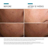 Skin Ceuticals Discoloration Defense Serum