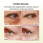 Dr. Melaxin Cemenrete Calcium Multi Balm 9g - Beauty Tribe