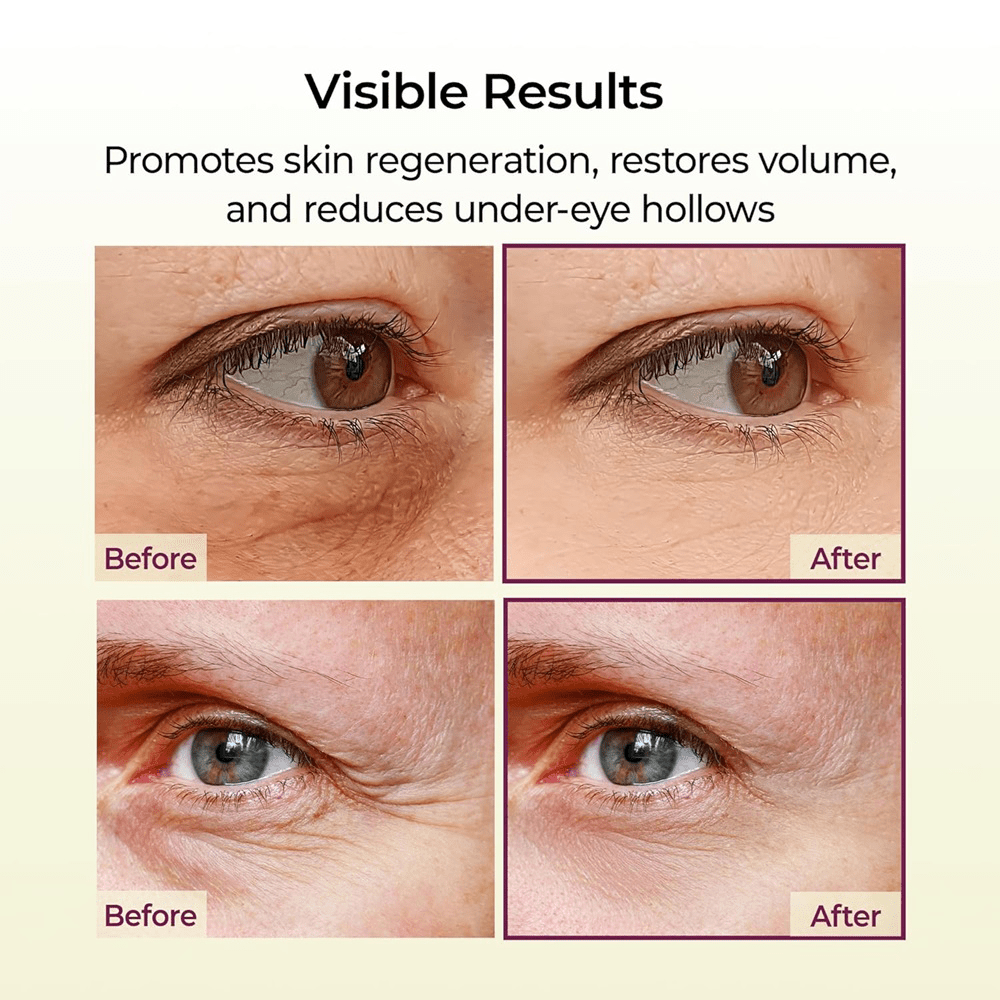 Dr. Melaxin Cemenrete Calcium Multi Balm 9g - Beauty Tribe