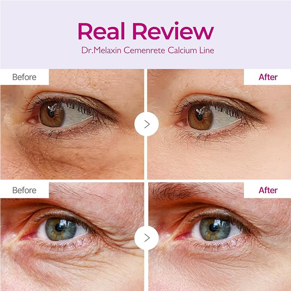 Dr Melaxin Cemenrete Calcium Volume Eye Patch 60ea