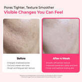 Dr. Melaxin Cemenrete Cyano Pink Spicule Serum 30ml - Beauty Tribe