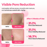 Dr. Melaxin Cemenrete Cyano Pink Spicule Serum 30ml - Beauty Tribe