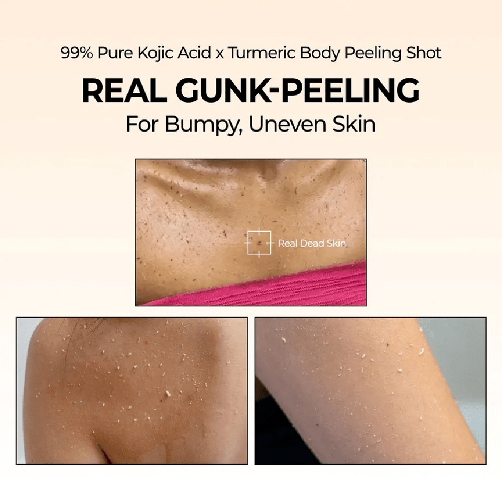 Dr. Melaxin Peel Shot Exfoliating Kojic Acid Turmeric Spray 200ml - Beauty Tribe